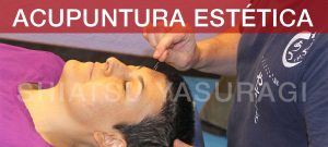 acupuntura aplicada a la estética