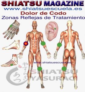 Epicondilitis Codo de Tenista Zonas Reflejas para aliviar el dolor