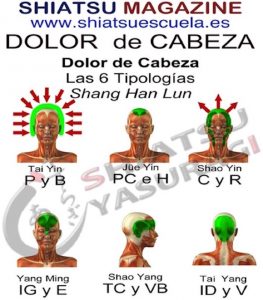 Dolor de Cabeza las Seis Tipologías.