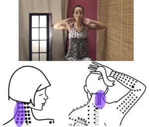 bruxismo