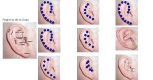 Perder peso con puntos en la oreja