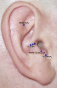 Perder Peso con Puntos en la Oreja-