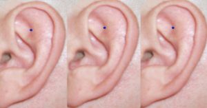 Esto Pasa Si Presionas Este Punto en la Oreja